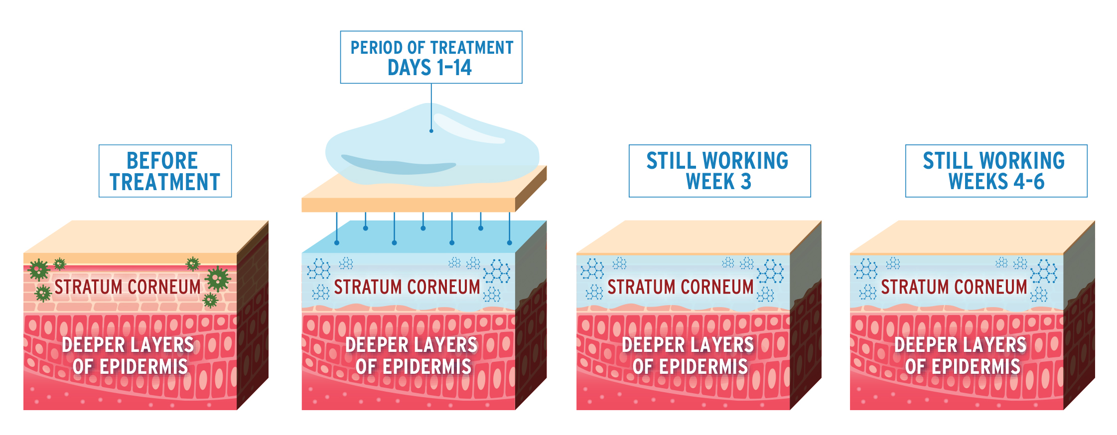 Illustration of infected skin layers showing Naftin Gel 2% penetrating and forming a reservoir within the layers of the stratum corneum.